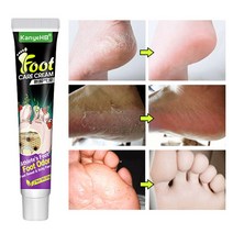 무좀 치료 발가려움 연고 항감염 무좀치료제 풋 케어 연고, 3개, 1개