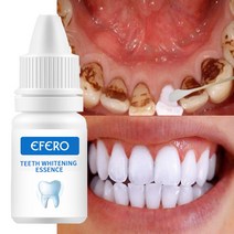 치아 미백 세럼 파우더 구강 위생을 효과적으로 청소 치과 플라크 얼룩 제거 노란색 치료 도구, 없음, 한개옵션0