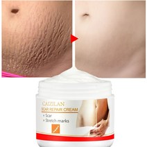 흉터 수리 크림 ​​여드름 흉터 제거 임산부 스킨 케어 스트레치 마크 제거 출산 지방 줄무늬 gravidarum 30g, 없음, 1개
