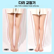 오다리 O자형 X자다리 교정기 휜다리 종아리성형, 성인 럭셔리] XO(종아리외반)+자석 2쌍