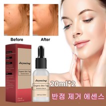 20ml*2 얼굴 반점 제거 에센스 검버섯 기미 주근깨 반점제거에센스정품 브라이트닝 반점 제거 반점 제거 에센스 기미앰플, 20ml, 1개