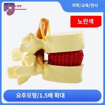 인간 데모 확대 교육용 의학 요추모형, 옐로우 컬러