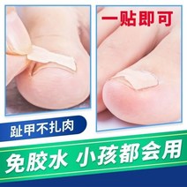 내성발톱교정기 네일 염증 교정기 발톱 특수 필링 패드 아티팩트 임베디드 정형 롱 고기 교정, [05] 풀이 필요 없는 네일 스티커 [80개]