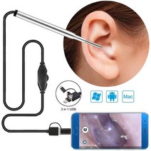 훤히잘보이는귀청소내시경3.9MM 스마트 Otoscope USB 귀 내시경 비디오 카메라 전문 검사 제거 청소 키트, 중국, 1.5m, 3 in 1 Seliver, 2.1.5m - 3 in 1 Seliver
