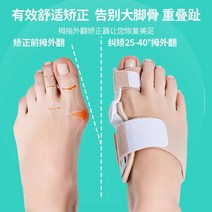 외지무반증 무지외반증수술 발가락기형 교정기 외반교정기 발가락모양 발교정기 엄지발 돌출뼈, 1pc
