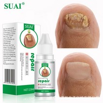 발바닥 각화형 무좀 발톱무좀 치료 약 연고 발냄새없애는법, 2개