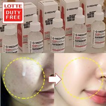 검버섯 기미뿌리 에센스 30ml/7일후 놀라운변화/미백기능성앰플 기미잡티, 미백에센스+줄기세포마스크10매+원장님아이톡 2개