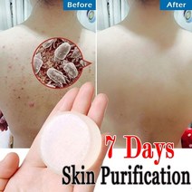 목욕비누 염소 우유 바다 소금 비누 청소 영양 오일 컨트롤 화이트닝 여드름 치료 진드기