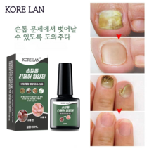 발톱무좀 리페어 에센스 천연 항진균제 발톱강화제 패디세이버 문제성 손톱 발톱 케어, 20ml, 2개