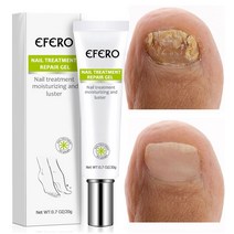 내성 발톱 교정 항진균 네일 젤 감염 방지 손톱 치료 핸드 풋 크림 수리 제거 곰팡이 손톱 에센스 제품