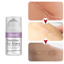 [당일배송] FEXMS 흉터제거연고 화상연고 켈로이드연고 수술 상처 켈로이드 흉터 흉터 케어, 20ml × 1개, 1개, 20ml