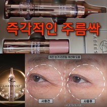 AHC 강력 팔자주름 앰플 300ML or 즉각 주름 보톡세럼(본품+리필) 세트, 즉각 주름 보톡세럼(본품+리필)2세트