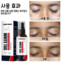 South Moon 얼굴백반증 피부 백반증 백반증원인, 30ML
