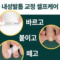 퍼펙토 내성발톱 치료 교정 팁 의료기기 세트, 14mm TOOL세트