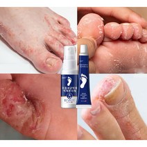 무좀약 스프레이 발톱무좀 치료 발냄새 제거 발가려움 연고, 2개, 1박스