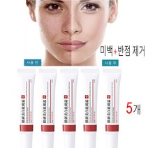 [정품 유효] 5개 화이트닝 주근깨 크림 기미 크림 제거 다크 스팟 제거 멜라닌 에이징 스킨 whitening freckle cream