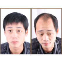 남성 가발 남자머리스타일 헤어 남자 장발 댄디컷 붙임머리 통 정수리, a 13 x14