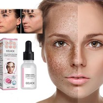 [당일배송] KORELAN 1 1 기미 제거 잡티 반점 수분 보습 화이트닝 산양태반 크림 멜라논크림, 15ml × 2개