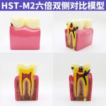 치아모형 인체모형도 치과기구 실리콘몰드 인체모형 양치교구 재료상, 6배 양측 대조