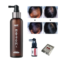 모톡스 두피케어 두피영양 나지르 두피토닉 두피에센스 남녀공용, 150ml, 1개
