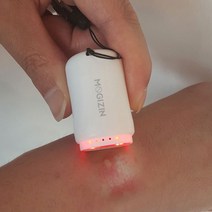 모기진 모기물렸을때 모기퇴치기 캠핑 낚시 골프 어린이 아기 가려움 제거, 화이트