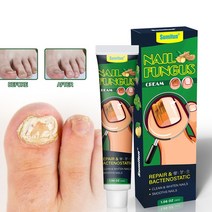 발톱무좀치료 발톱무좀약 발톱무좀 습진 가려움 발냄새 발각질 완화, 30g, 3개