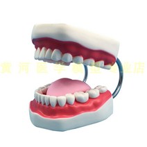 치아모형 인체모형도 치과기구 실리콘몰드 인체모형 양치교구 재료상 6배, 입 6배 확대