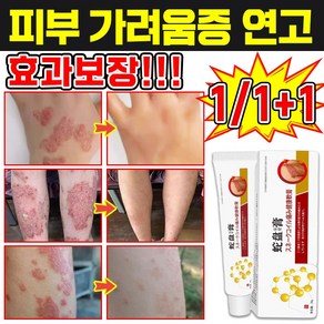 [일본 기술] 1/1+1 피부 가려움증 연고 한포진 습진 연고 건선 연고 치료제 피부염 모낭염 연고 지루성 피부염 각종 피부 트러블 곰팡이균 볽은반점 완화 크림, 1개, 20g