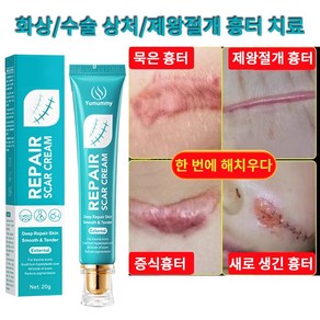 피부 관리 흉터 연고 화상 흉터 연고 화상연고, 1개, 20ml