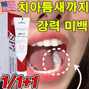 [딱 3일만 미백] 미국 SP7 프로바이오틱 유산균 미백 치약 유해균억제 화이트닝 구취제거 선물 잇몸 보호 랜덤 증정