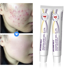 DERMFREE 여드름 리페어 크림 스팟 케어 문제피부 자국 모공 진정 피지케어 크림