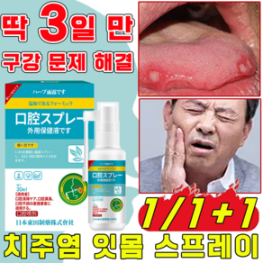 [구강 건강] 치주염 잇몸 스프레이 구내염 치통 스프레이 구강궤양 구내질환 예방 입냄새제거, 2개, 30ml