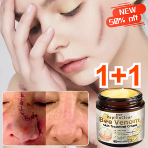 1+1 봉독 흉터 제거 크림 오래된 흉터 제거 크림 상처 흉터 재생크림, 60g*2개