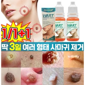 [국내배송] 미국 편평 사마귀 쥐젖 제거제 피부 제거 연고 기미 점빼기 크림 손 발 치료 제거액 피부 리페어 에센스, 1개, 10ml