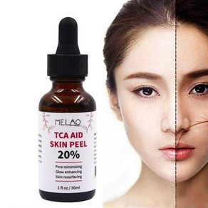 Tca Aid Skin Peel 20프로 스킨 필 모공 주름 케어 페이스 세럼 30ml, 1개