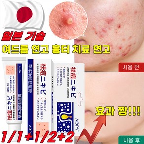 [국내배송] 일본 여드름 연고 흉터 치료 연고 청소년 피부 화농성 여드름 제거 리페어 연고 모공 진정 피지케어 크림, 30ml, 2개