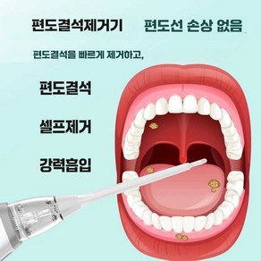 편도결석제거기 흡입기 셀프 구강 이물질 클리너 치석 입냄새차단, 1개, (3단계 흡입력 + 3가지 흡입 헤드)