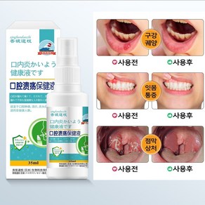 구내염 스프레이 구강 염증 혀염증 구강 궤양 잇몸염 스프레이, 1개, 35ml