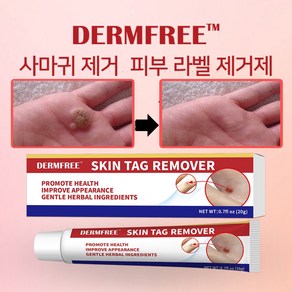 Demfee 천연 허브 포뮬러 피부 깊은 층 침투 재발 방지 안전하고 효과적 W021, 1개, 20g