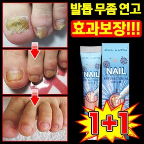 [빠른 배송] 내성 발톱 연고 무좀약 손톱 발톱 치료제 문제성 손발톱 영양제 풋 솔루션 케어 앰플