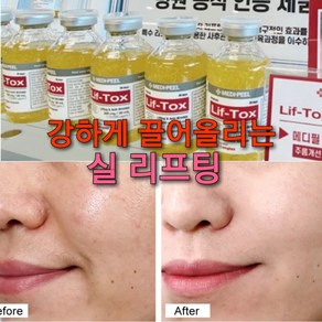 리프팅앰플 리프톡스, 30ml, 1개