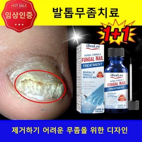 [효과보장]진균 억제 전공 손톱 손질, 2개, 20ml