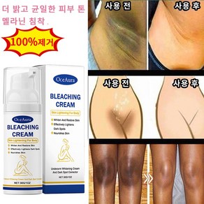 멜라토닌 크림 바디 미백 겨드랑이 엉덩이 색소 침착 연고, 1개, 30ml