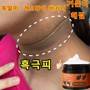 MEJIOSS [대용량] 멜라토닝크림 색소침착 연고 색소침착연고 겨드랑이 색소침착 색소침착연고 멜라닌 억제, 1개, 140g