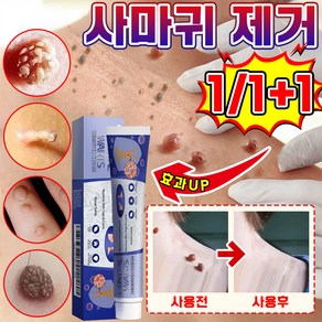 [국내배송] 1+1/2+2 미국 피부 치료 제거 연고 신속하고 효과적인 제거 스킨 제거 크림 최저가격 포장증정, 2세트, 20g