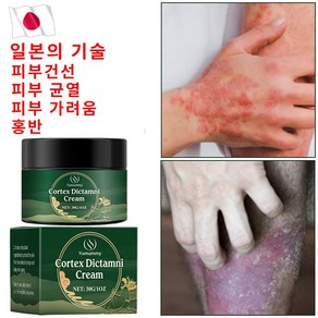 피부 가려움증 홍반 습진 두드러기 건선 완화 피부 붉은반점, 1개, 30ml