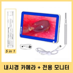 코지로움 귀 내시경 카메라 모니터 귀이개 귀지제거, 화이트 7인치 모니터, 1개, 1개입