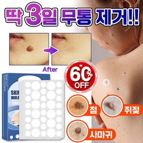 [빠른배송] 피부 제거 패치 얼굴 바디 피부 치료 라벨 스텔스, 2개, 144매입