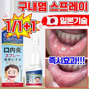 [빠른배송] 구내염 잇몸 염증 구강 스프레이 치주염 혀 구내염 약 가글 미스트 구취 제거 항균 혓바늘 구강 궤양 통증 치료 마우스 스프레이, 1개, 30g