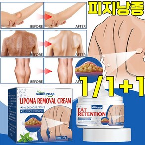 [미국 기술] 피지낭종 연고 피부 표피낭종 제거 연고 지방종 완화 크림 피부과 전용, 3개